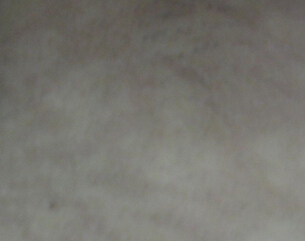 人ưĸҽԺã˰װ߸ô