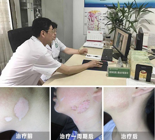 彩虹公益·秋季白癜风公益普查暨规范化诊疗 彩虹公益·秋季白癜风公益普查暨规范化诊疗
