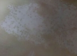 人ļҽԺΰã֢״